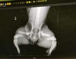 X ray